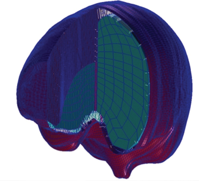 13-14_PediatricBrainInjuryAssessment.jpg
